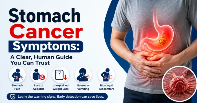 stomach cancer symptoms